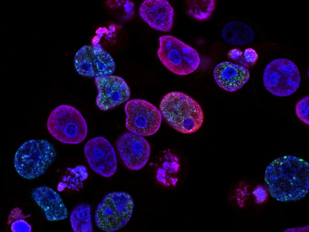 Cellules souches mésenchymateuses dans les maladies neurologiques : mécanismes paracrines et application clinique