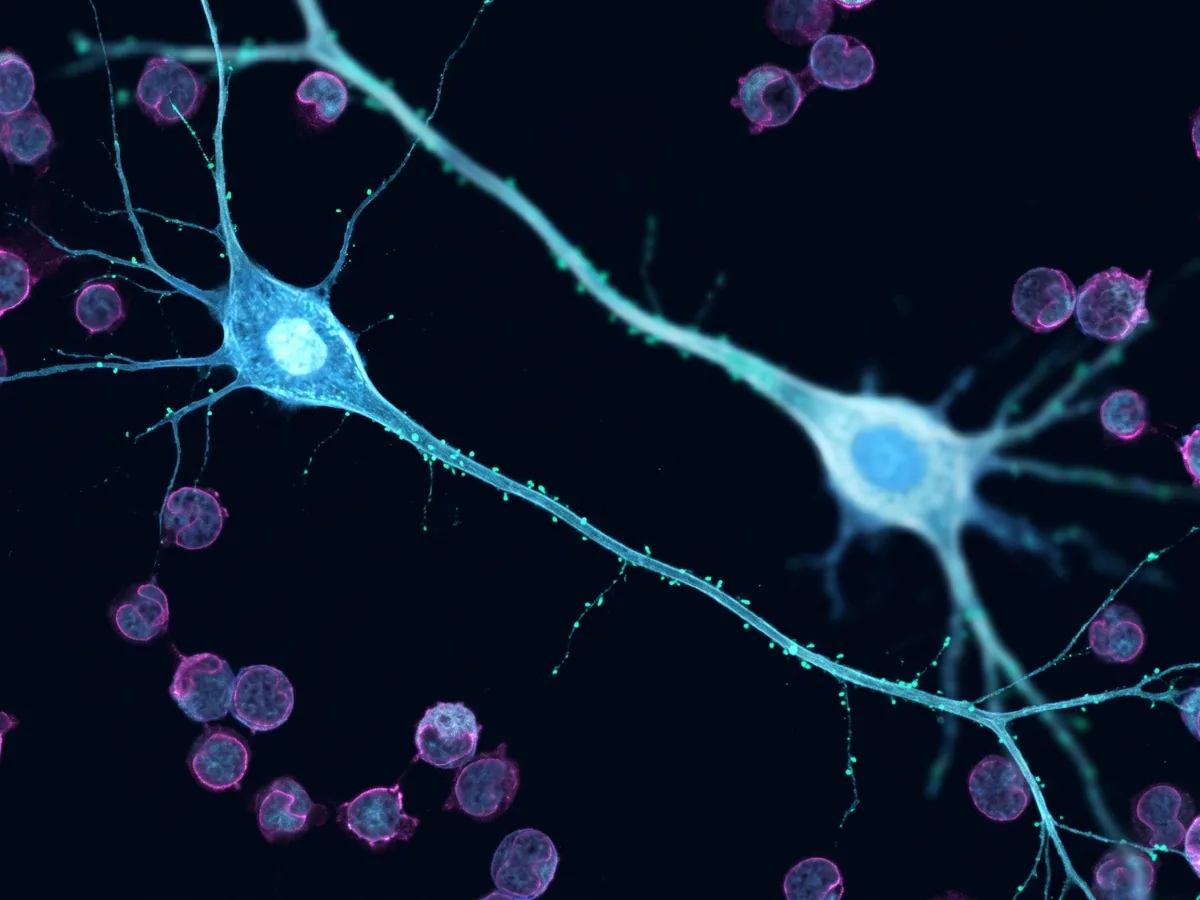 Regulatory T-Cells in ALS: Mechanism and Emerging Clinical Evidence